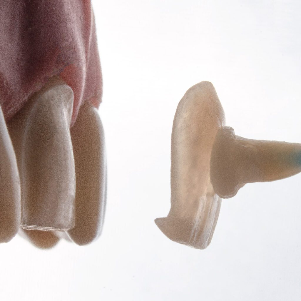 Services Black Coral Dental Braces and Implant Centre